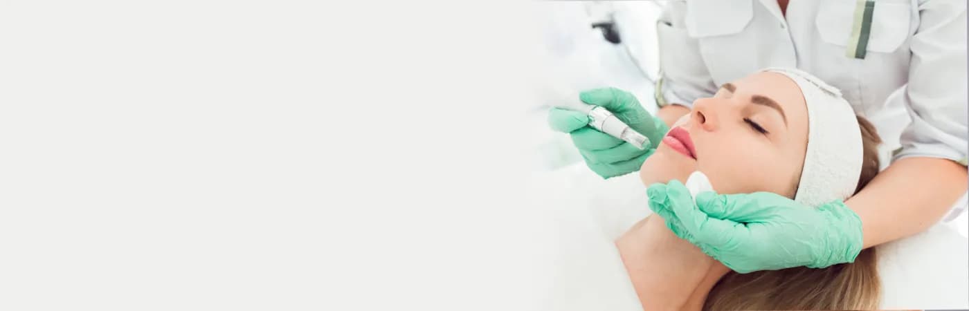 Microneedling