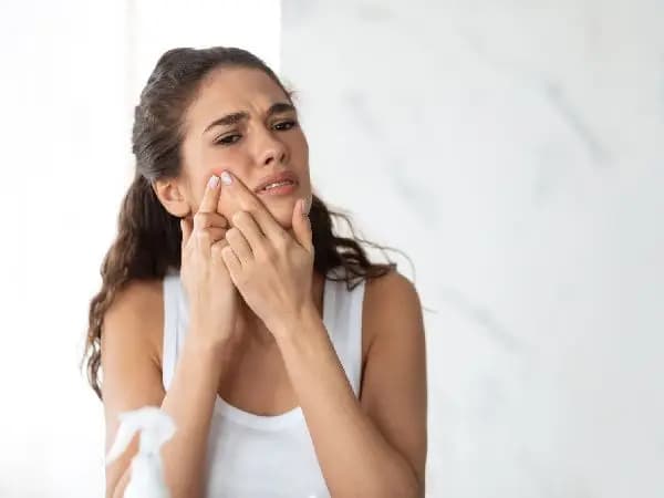 Acne Treatment